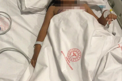 Ankara'da 2 kardeşe saldırıp yaralayan pitbullun sahibi tahliye edildi